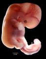 Embrión, feto.jpg