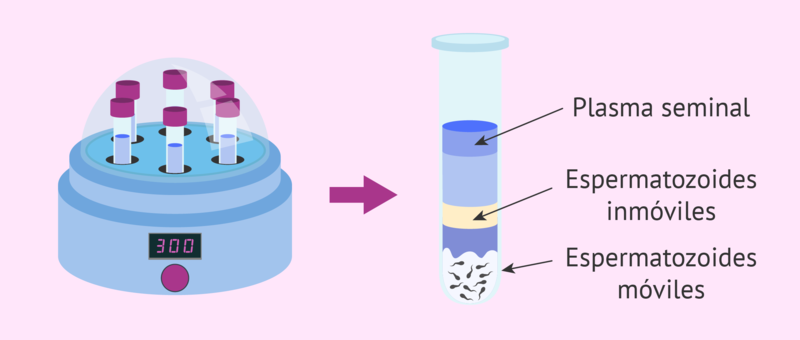 Archivo:Capacitación de esperma.png