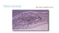 Moco-cervical G.jpg