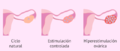 La Hiperestimulación de la Ovulación.png